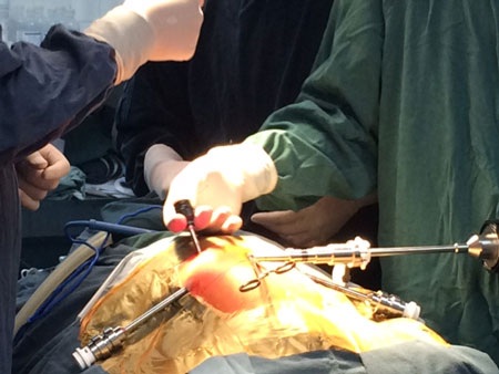 Bệnh viện Nhi TW thực hiện thành công 54 ca phẫu thuật nội soi robot - 1 Bệnh viện Nhi TW thực hiện thành công 54 ca phẫu thuật nội soi robot