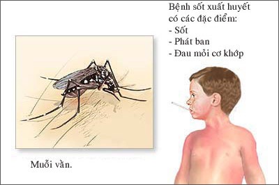 Đã có 3 trường hợp tử vong vì sốt xuất huyết - 1 Đã có 3 trường hợp tử vong vì sốt xuất huyết