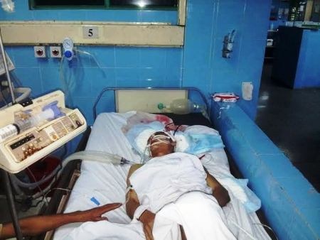 Bị ong rừng tấn công, nam thanh niên chấn thương sọ não - 1 Anh Đinh Văn Năm đang được điều trị tích cực tại Bệnh viện