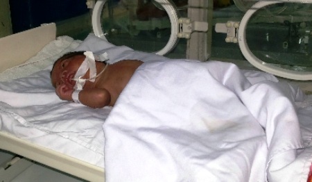 Cứu sống trẻ sinh non nặng 800g