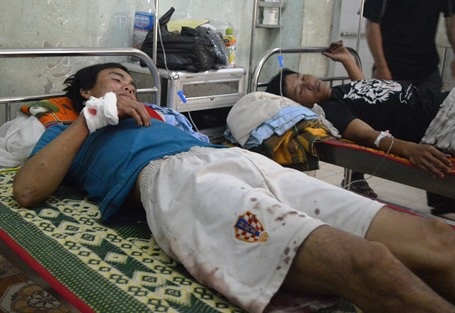 Vụ nổ đã khiến anh Nam và anh Sỹ bị thương nặng nhập viện trong tình trạng đa chấn thương