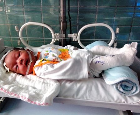 Hình ảnh bé Thùy Nhi lúc mới sinh ra bị bố mẹ bỏ rơi nơi bệnh viện