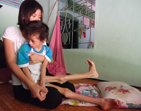 Nhật Lam sau khi mắc bệnh lạ đã bị bại não, co rút tứ chi