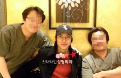 Lee Min Ho bị nghi phẫu thuật thẩm mỹ - 1