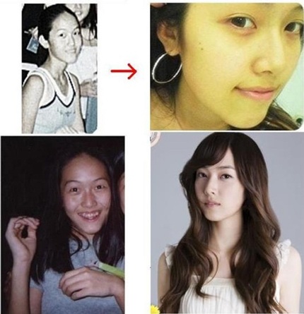 Những mỹ nhân bị nghi ngờ “dao kéo thẩm mỹ” - 24