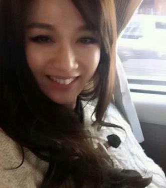 Những mỹ nhân mặt bỗng sưng vù vì phẫu thuật thẩm mỹ - 12