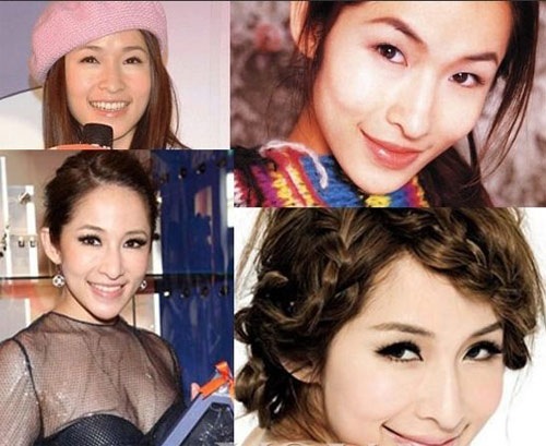 Những mỹ nhân mặt bỗng sưng vù vì phẫu thuật thẩm mỹ - 14