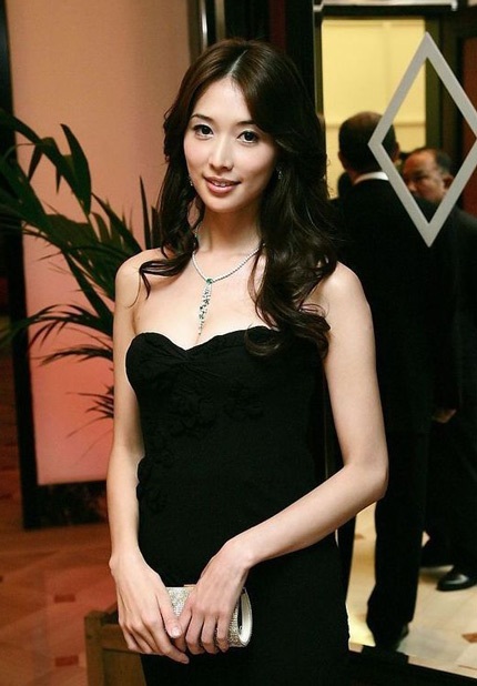 Những mỹ nhân mặt bỗng sưng vù vì phẫu thuật thẩm mỹ - 1