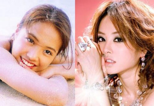 Những mỹ nhân mặt bỗng sưng vù vì phẫu thuật thẩm mỹ - 16