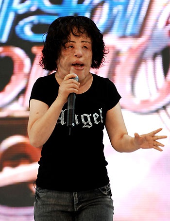 Sau gần 20 lần phẫu thuật thẩm mỹ, gương mặt của nữ ca sĩ - Han Mi Ok bị biến dạng khủng khiếp.