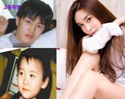 Người đẹp chuyển giới xứ Hàn biến dạng vì phẫu thuật 