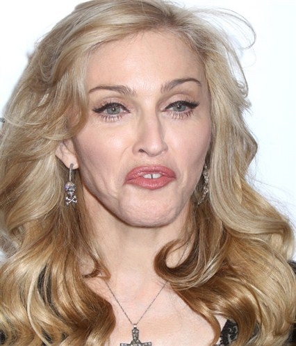 Những khoảnh khắc xấu tệ của “sao” - 18 Bao nhiêu Botox và các liệu pháp trẻ hóa cũng không thể “cứu” Madonna thoát khỏi tuổi già.