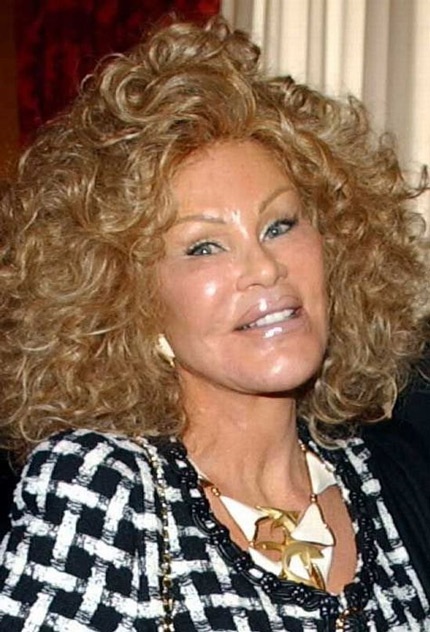 Gương mặt nặng botox và vết dấu thẩm mỹ khiến ngôi sao ngoài 70 tuổi ngày một đáng sợ và dị thường!