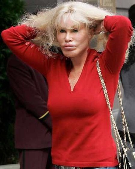 Gương mặt nặng botox và vết dấu thẩm mỹ khiến ngôi sao ngoài 70 tuổi ngày một đáng sợ và dị thường!