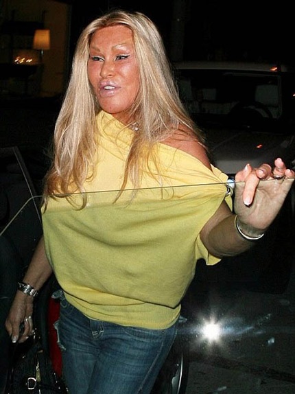 Gương mặt nặng botox và vết dấu thẩm mỹ khiến ngôi sao ngoài 70 tuổi ngày một đáng sợ và dị thường!