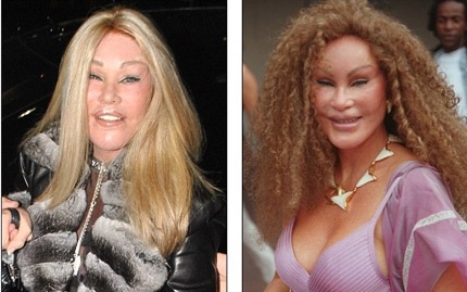 Gương mặt nặng botox và vết dấu thẩm mỹ khiến ngôi sao ngoài 70 tuổi ngày một đáng sợ và dị thường!