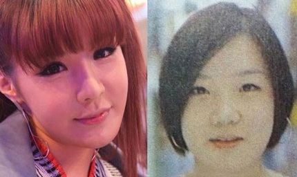 Park Bom luôn bị nghi vấn dao kéo nhưng cô luôn phủ nhận...