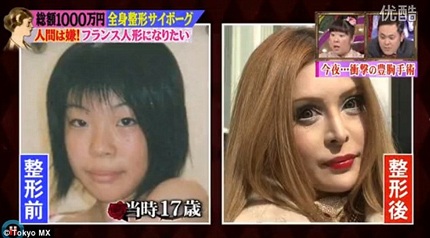 Gặp cô gái trải qua 30 ca phẫu thuật để thành búp bê sống - 2 Gặp cô gái chi 100 nghìn USD để thành búp bê sống