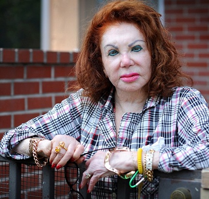 Số với gương mặt biến dạng của sao “nghiện” phẫu thuật thẩm mỹ