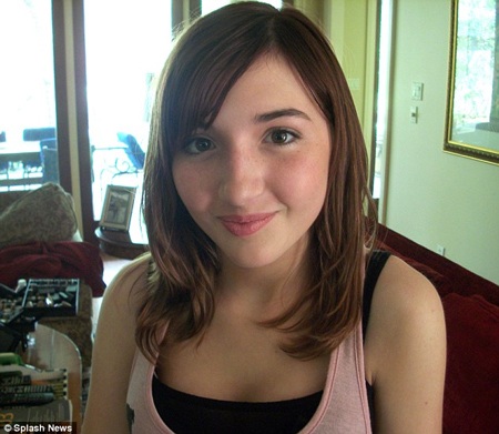 Ashley khi chưa phẫu thuật thẩm mỹ