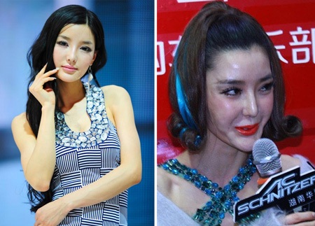 Người đẹp Lý Dĩnh Chi của Trung Quốc ngày càng biến dạng đáng sợ sau những ca sửa cằm, bơm môi.