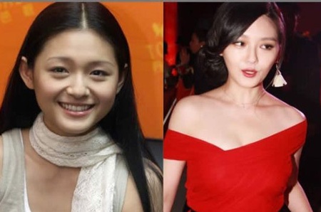 Những mỹ nhân châu Á bị nghi gọt cằm