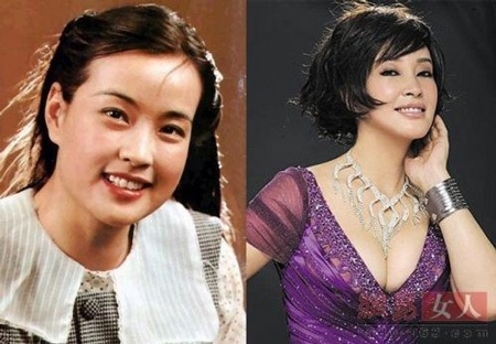 Phạm Băng Băng cũng dính nghi án dao kéo chỉnh sửa cằm.