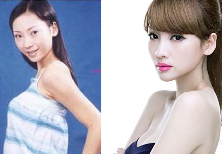 Siêu vòng một Liễu Nham không chỉ làm mặt mà còn bơm ngực?