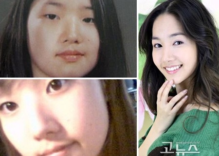 Siêu vòng một Liễu Nham không chỉ làm mặt mà còn bơm ngực?