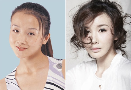 Siêu vòng một Liễu Nham không chỉ làm mặt mà còn bơm ngực?