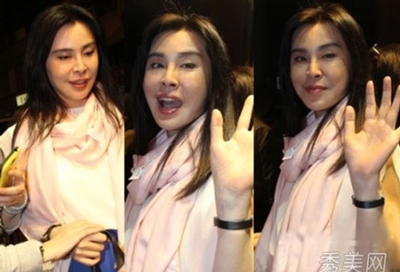 Siêu vòng một Liễu Nham không chỉ làm mặt mà còn bơm ngực?