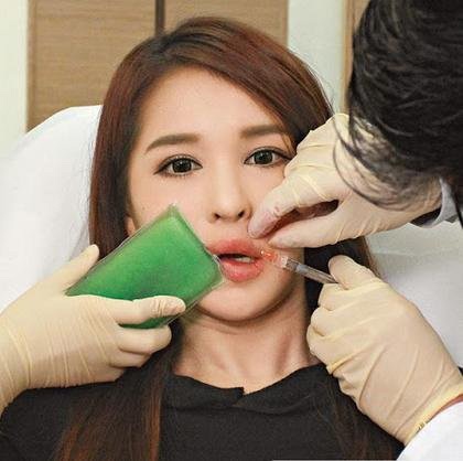 Cận cảnh một ca bơm môi làm đẹp - 2 Vẻ đẹp gợi cảm của Thư Kỳ là hình mẫu lý tưởng của phụ nữ Hồng Kông