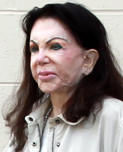Nữ diễn viên 92 tuổi mặt méo xệch vì phẫu thuật thẩm mỹ - 1 Jackie Stallone với gương mặt méo xệch vì phẫu thuật thẩm mỹ