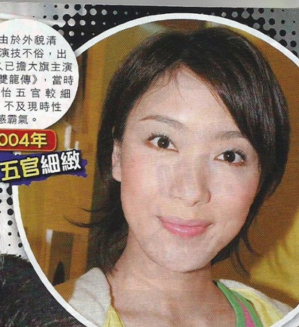 Ngôi sao Hồng Kông mặt méo mó vì phẫu thuật thẩm mỹ