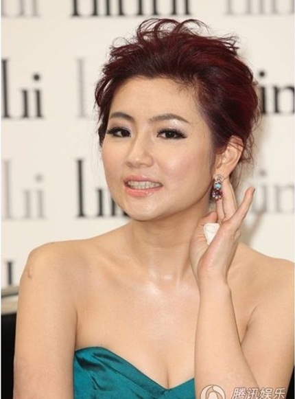 Hơn 3 năm sau vụ tai nạn, Selina đã bớt mặc cảm khi để lộ những vết sẹo trên cánh tay. 