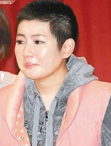 Nữ ca sĩ bị bỏng tự tin để lộ mặc váy không ngại sẹo