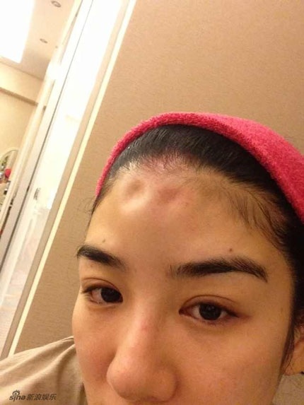 Huỳnh Dịch công bố chứng cứ tố chồng đánh đập cô trên trang cá nhân.