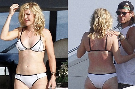 Nữ ca sĩ 27 tuổi để lộ những vết cháy nắng trên cơ thể khi diện áo tắm.