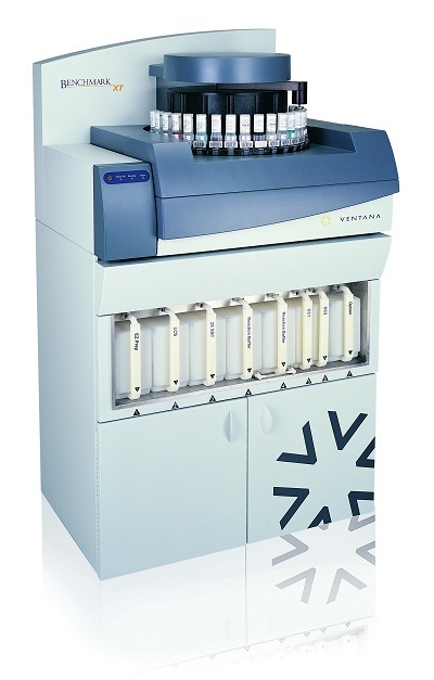 Tiến bộ mới trong chẩn đoán ung thư - 2