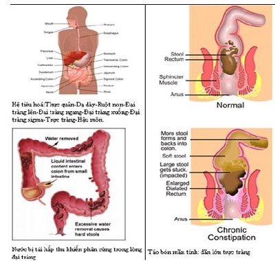 Táo bón - Nguyên nhân và giải pháp - 2 Táo bón - Nguyên nhân và giải pháp - 2