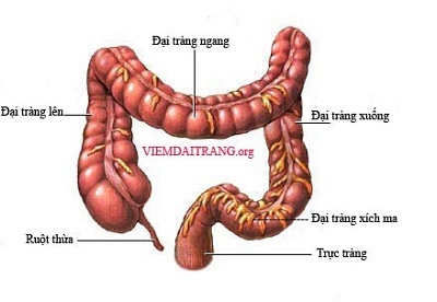 Bệnh viêm đại tràng mạn tính - 1