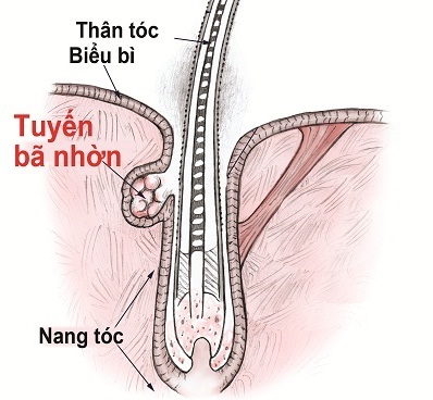DHT - "Thủ phạm giấu mặt" của chứng rụng tóc, hói đầu! - 1 DHT - "Thủ phạm giấu mặt" của chứng rụng tóc, hói đầu! - 1