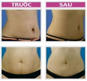 Phục hồi làn da rạn nứt - 2 Phục hồi làn da rạn nứt - 2
