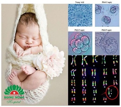 Phương pháp Micro Array không chỉ lựa chọn giới tính và phôi thai khỏe mạnh nhất