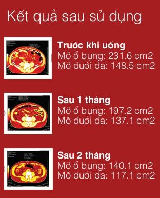 Những điều cần biết về thực phẩm chức năng giảm cân - 2 Kết quả kiểm chứng lâm sàng của hiệu quả giảm mỡ của Lactoferrin GX