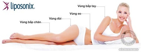 Công nghệ đỉnh cao cho phom dáng hoàn hảo - 1 Liposonix – công nghệ giảm béo sau 1 giờ duy nhất