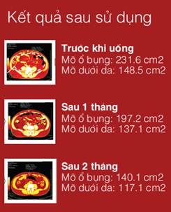 Kết quả kiểm chứng lâm sàng hiệu quả giảm mỡ của Lactoferrin GX