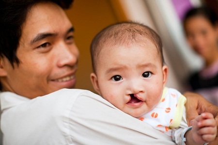 Hành trình của một bà mẹ tìm lại nụ cười cho con - 4 Hành trình của một bà mẹ tìm lại nụ cười cho con
