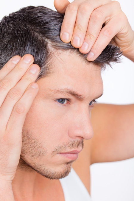 Da đầu nhờn – Nỗi khổ của chàng - 2 Gàu là vấn đề phổ biến từ da đầu nhờn