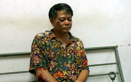 Hà Nội: Lời khai kẻ sát hại vợ trước ngày ra tòa ly hôn - 1 Đoàn Thạch Cương bị thương trong quá trình trốn chạy.